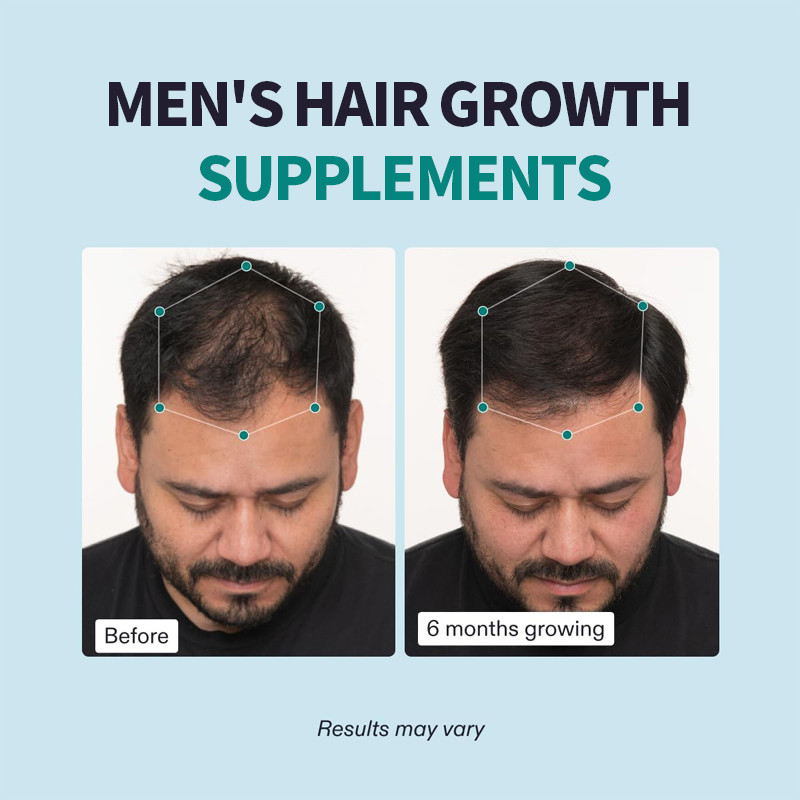 OEM Men'S Hair Growth Supplements Visibly Thicker Hair And Scalp Coverage Men Hair Capsules