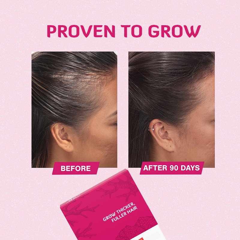 Hair Growth Tablets 120mcg Biotin Hair Growth Product For Hair Growth