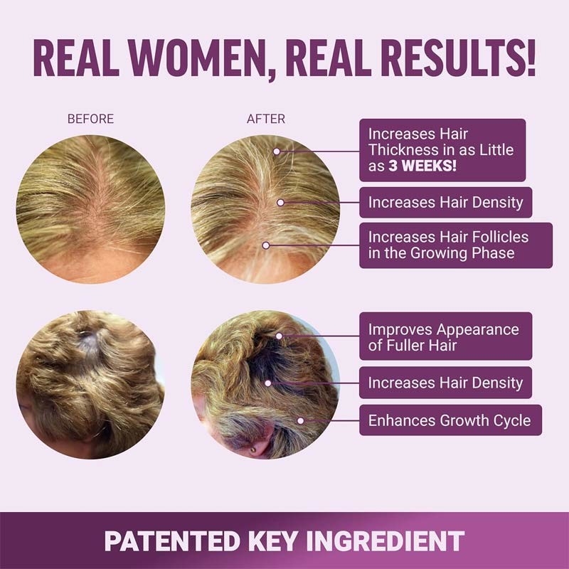 Hair Growth Accelerator Soft Chews Gummies Hair Growth Gummies For Strength Hair