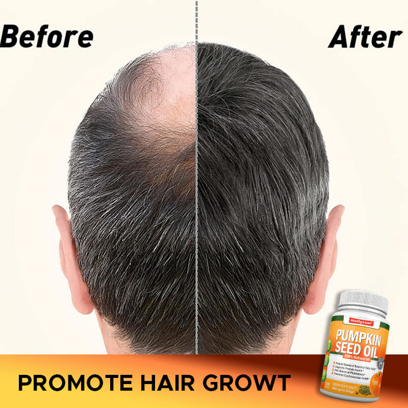 Factory Pumpkin Seed Oil Softgels Hair Prostate Joint Health Omega-3 Essential Fatty Acid Supplement