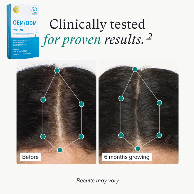 OEM Hair Growth Food Supplement Hair Growth Tablets For Strong Natural Hair Growth