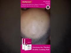 Red Hair Growth Tablets